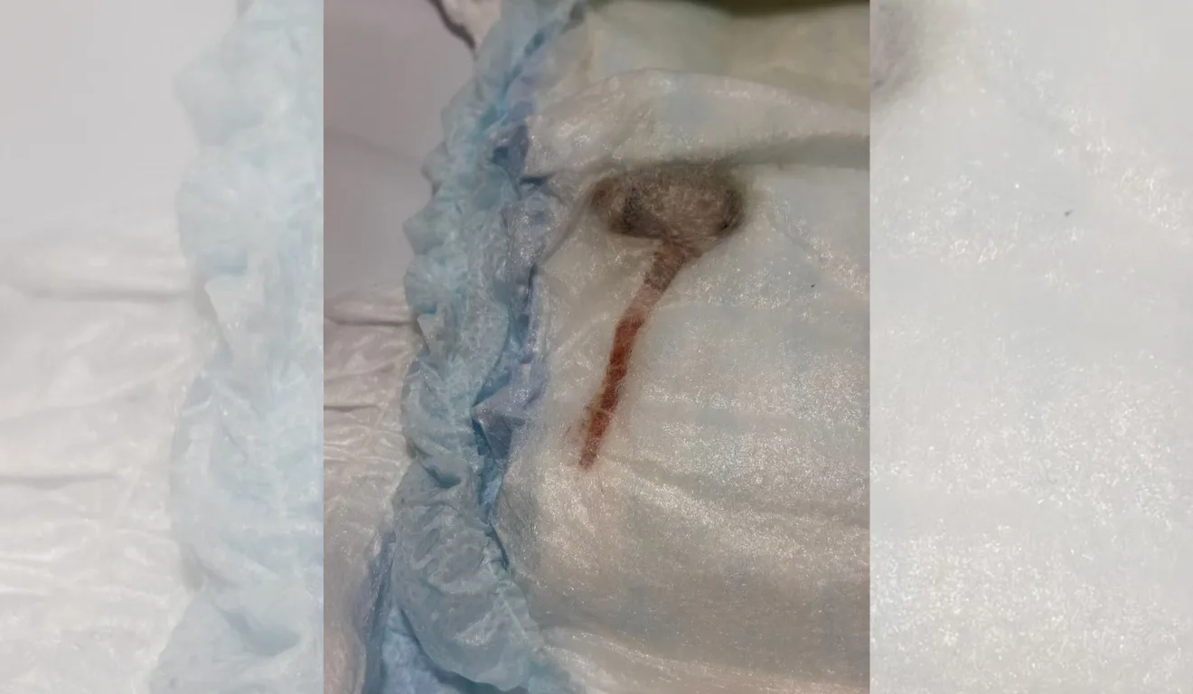 Rato encontrado em fralda de bebê no Rio