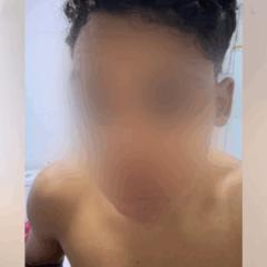 Jovem que ficou ferido com a linha cortante