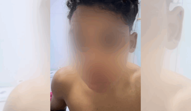 Jovem que ficou ferido com a linha cortante