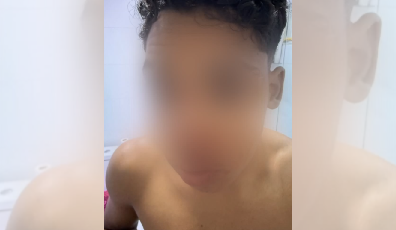 Jovem que ficou ferido com a linha cortante