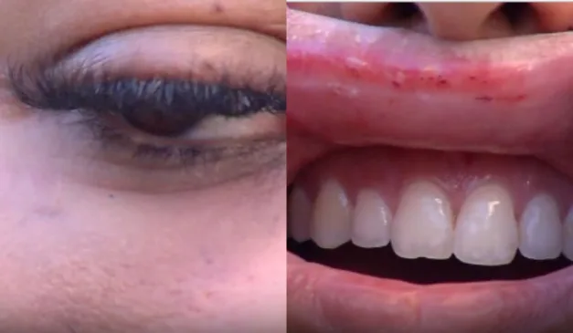 Foto: Reprodução/ TV Vitória