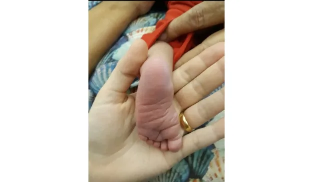Pezinho da Bebela