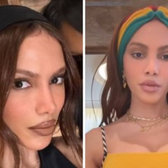 Anitta após procedimento estético