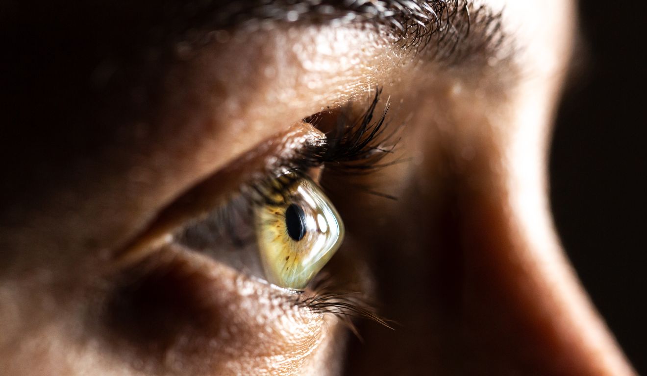 ceratocone doença ocular