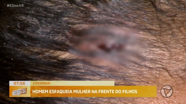 Mulher denuncia ex-companheiro após agressões em Vila Velha