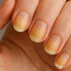 Esses hábitos podem deixar as unhas amareladas/Foto: ChatGPT