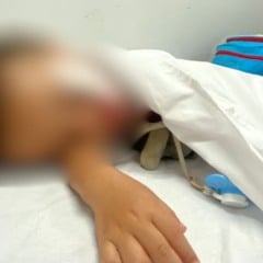 bebê atacado por pitbull