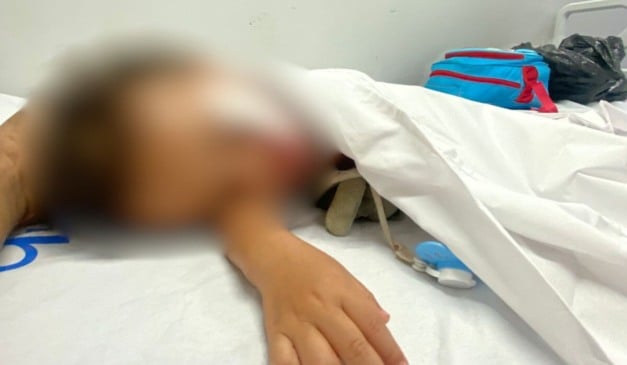 bebê atacado por pitbull