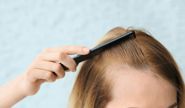 Esses erros fazem parecer o seu cabelo mais fino/Foto Canva