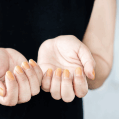 Doença de unhas/Foto Canva