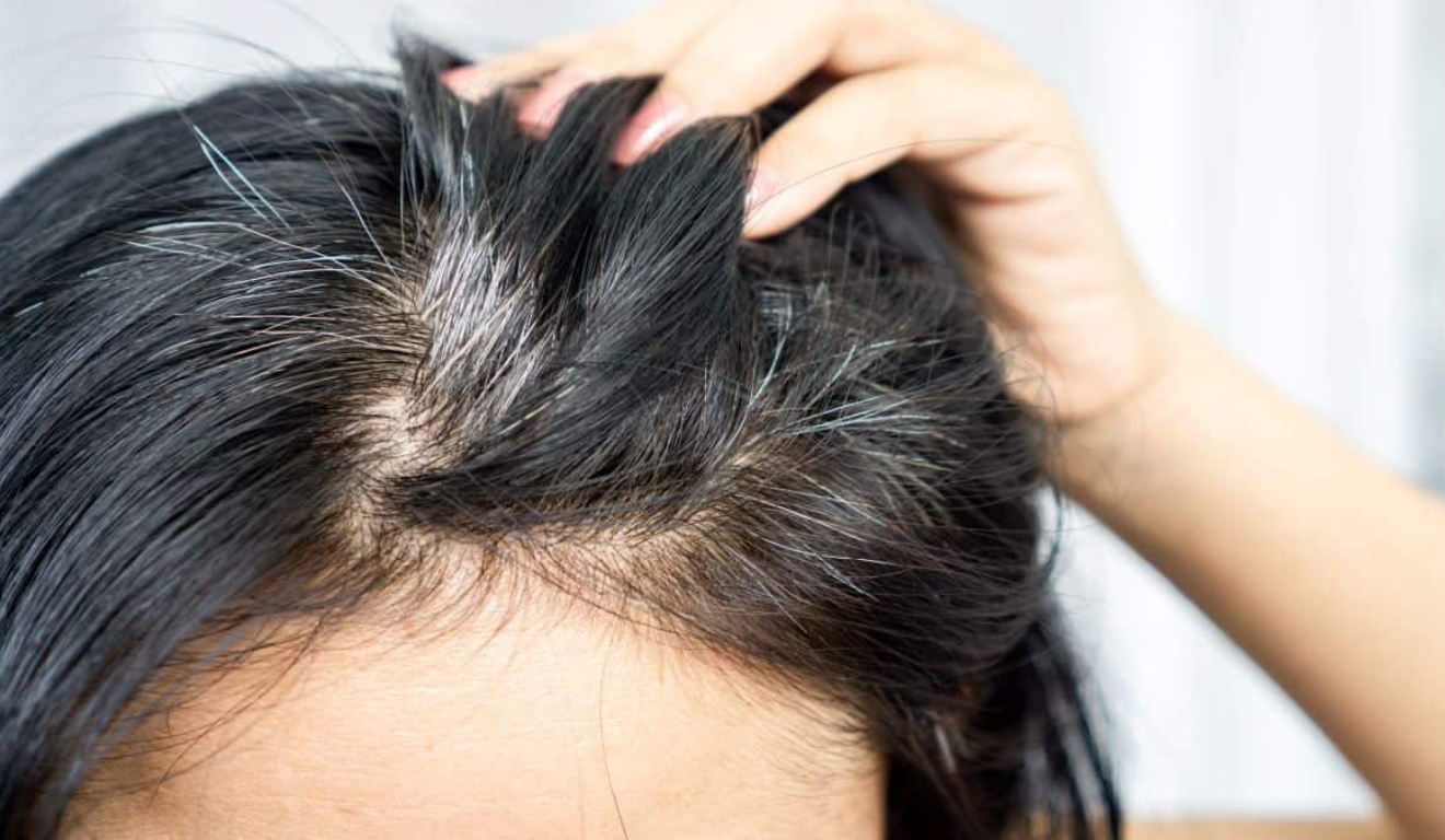 Foto: Reprodução / Shutterstock