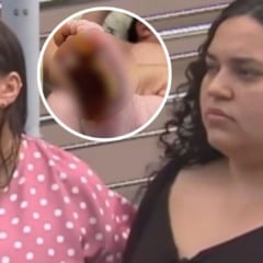 Bebê teve pé queimado em hospital (Foto/montagem: Folha Vitória)