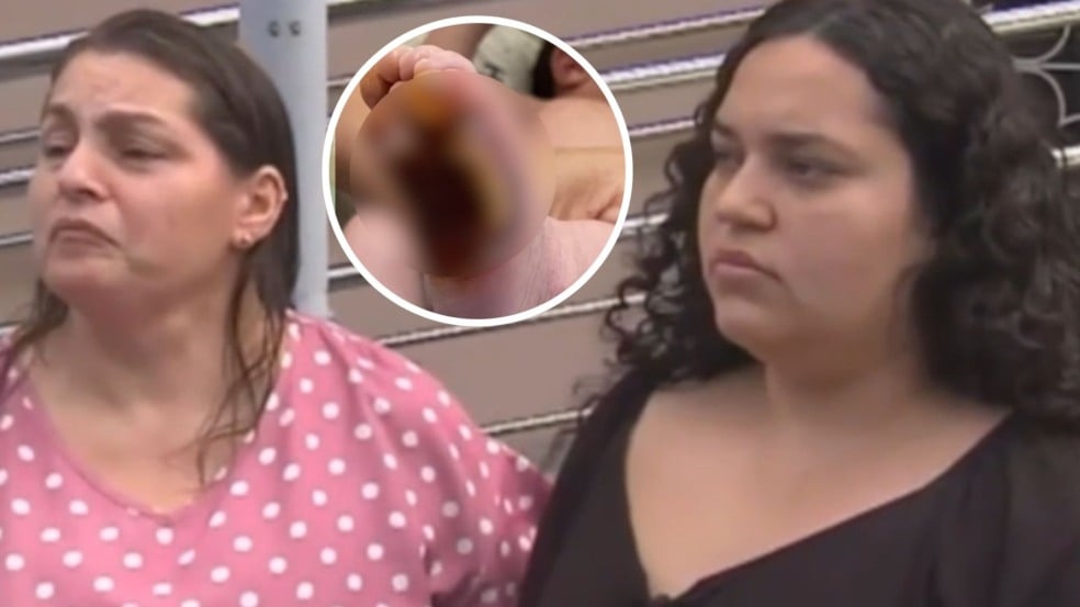 Bebê teve pé queimado em hospital (Foto/montagem: Folha Vitória)
