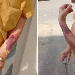 Idoso é agredido em Cariacica