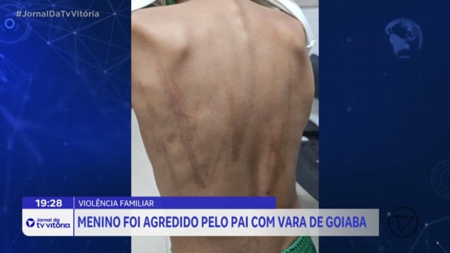 Menino agredido pelo pai é acolhido após denúncia na escola