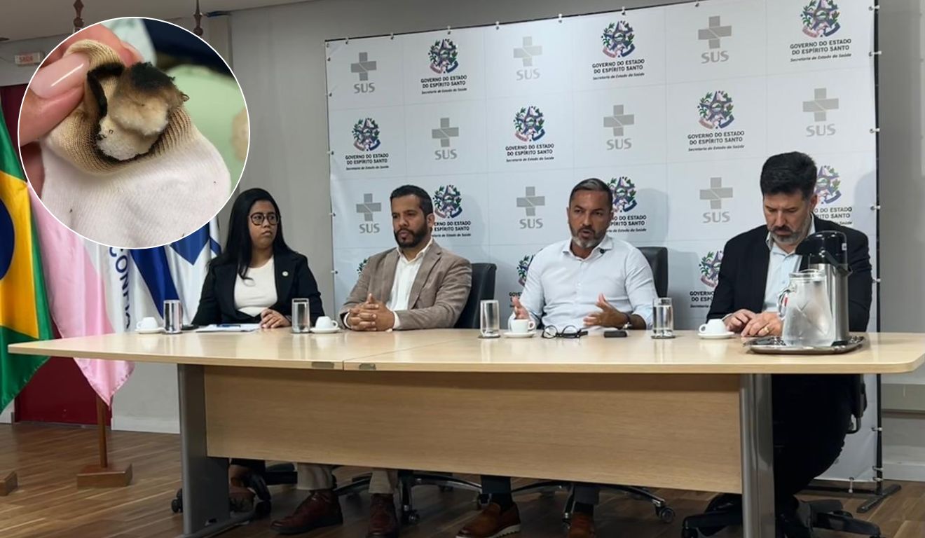Coletiva bebê pé queimado