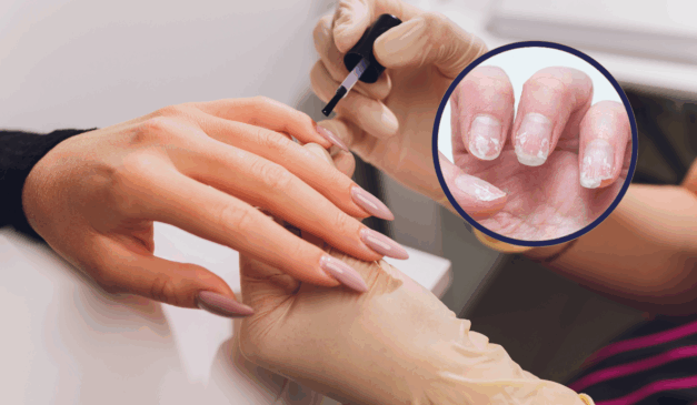 Unhas frágeis podem ser resultado de hábitos diários e falta de cuidados específicos (Foto: Reprodução/Canva)