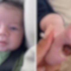 José, bebê que teve o pé queimado na Serra