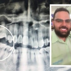 Vendedor Luan Vinícius Alves Gonzaga morreu após retirar dentes sisos