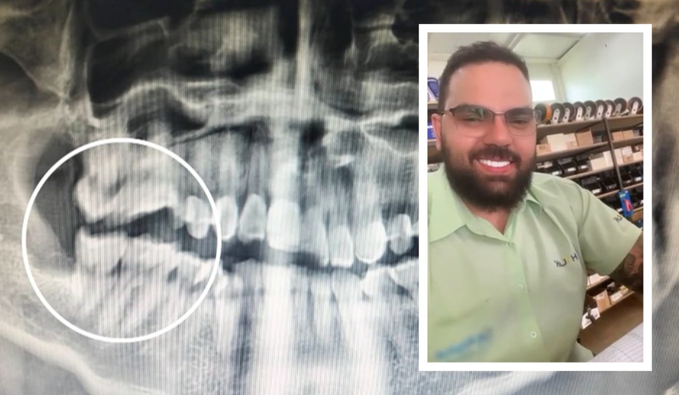 Vendedor Luan Vinícius Alves Gonzaga morreu após retirar dentes sisos