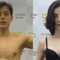 Bella Longuinho em seu antes e depois (Foto:Reprodução/Instagram @bella_longuinho)