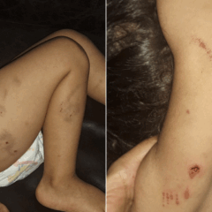 Foto: Reprodução / Mãe da criança. 