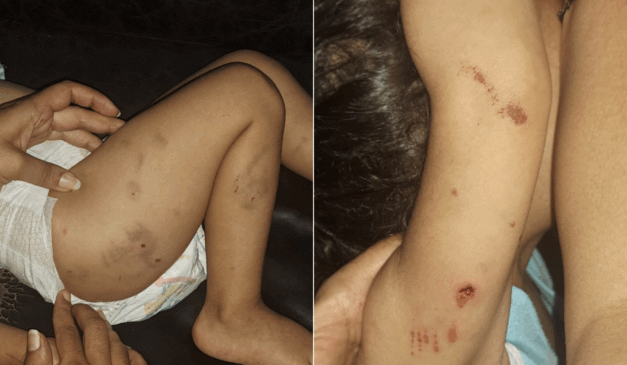 Foto: Reprodução / Mãe da criança. 