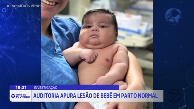 Bebê de 6,5 kg sofre lesão durante parto em Colatina