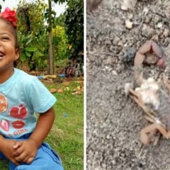 A menina Isabelly Almeida Silva foi picada por escorpião em distrito de São Mateus