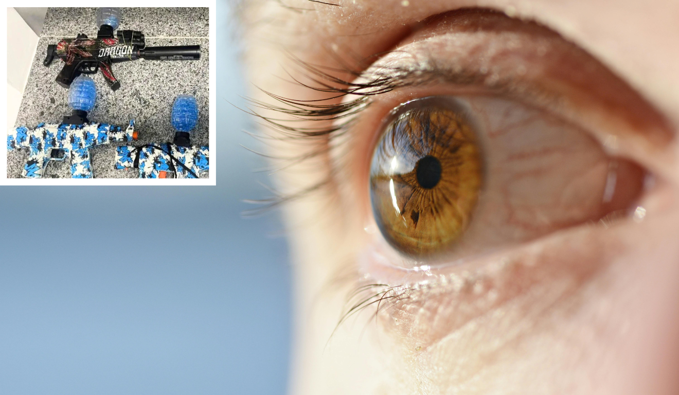 Brincadeira com arma de gel risco de perda de visão Brincadeira com arma de gel risco de perda de visão