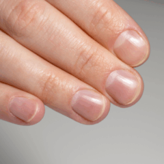 A cor das unhas pode refletir o estado de saúde do organismo; alterações persistentes devem ser investigadas/Canva