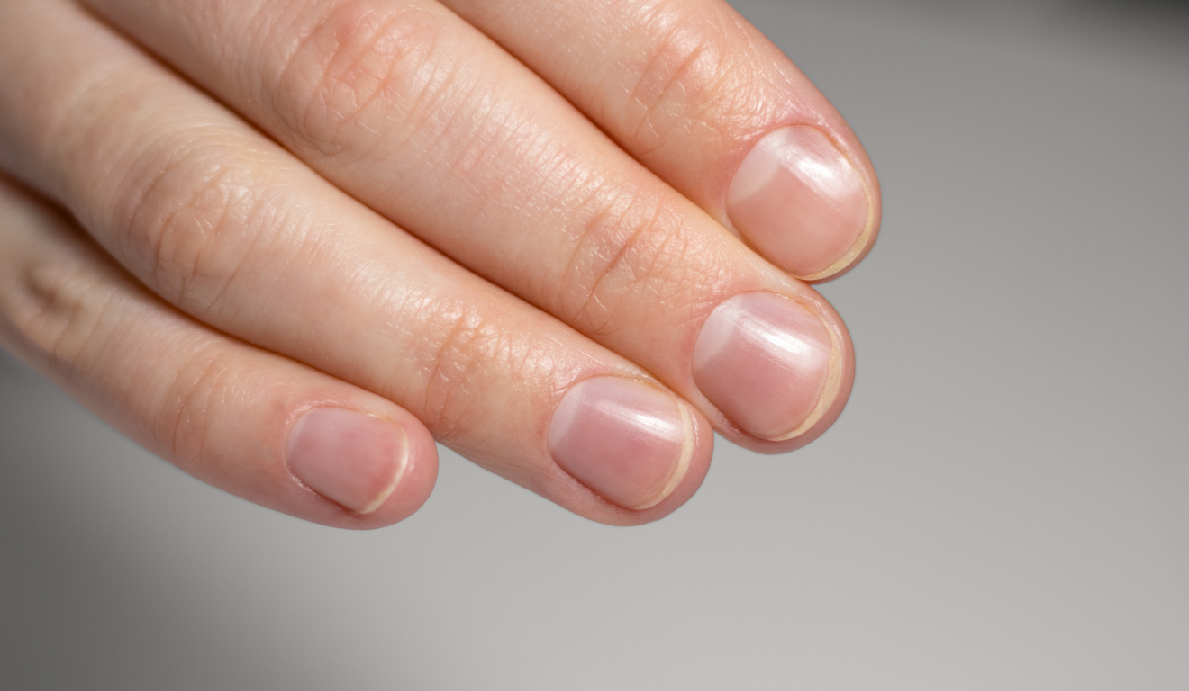 A cor das unhas pode refletir o estado de saúde do organismo; alterações persistentes devem ser investigadas/Canva