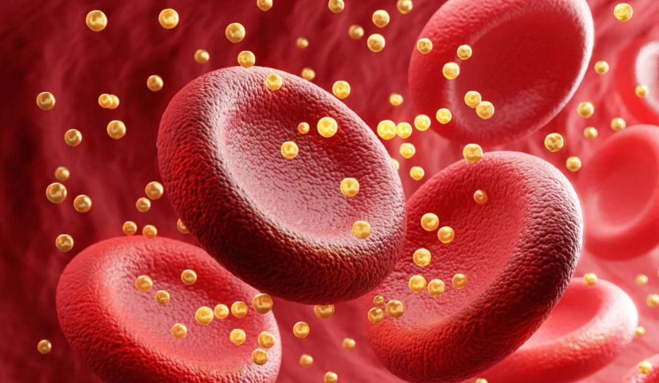 Lipoproteína (a) Lipoproteína (a)