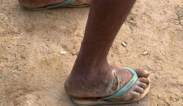 Foto: Arquivo MPT