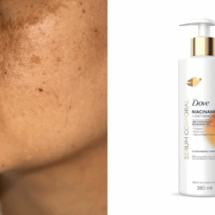 Produto da Dove com niacinamida acaba com as manchas do corpo e pele
