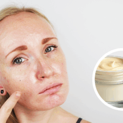 A pele oleosa pode ser controlada com os cuidados certos e os produtos adequados, garantindo um aspecto saudável e livre de brilho excessivo