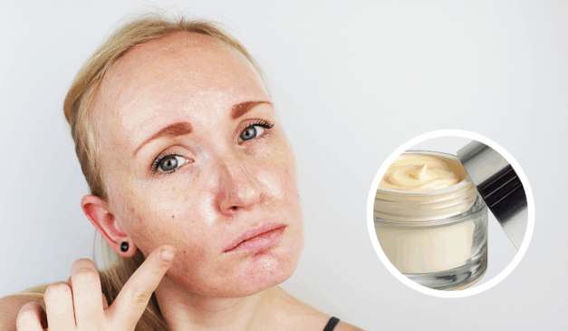 A pele oleosa pode ser controlada com os cuidados certos e os produtos adequados, garantindo um aspecto saudável e livre de brilho excessivo