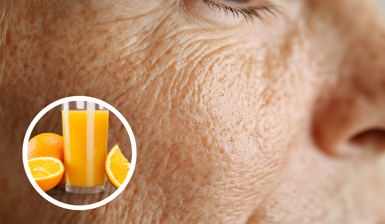 Suco natural com laranja, cenoura e gengibre contribui para a hidratação e firmeza da pele, ajudando a suavizar as rugas/Canva Suco natural com laranja, cenoura e gengibre contribui para a hidratação e firmeza da pele, ajudando a suavizar as rugas/Canva