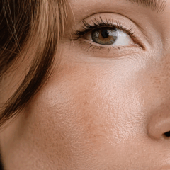 Poros dilatados podem ser controlados com hábitos simples que deixam a pele mais lisa, suave e saudável