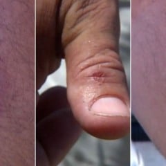 Motorista de aplicativo levou várias mordidas. Foto: Reprodução/TV Vitória