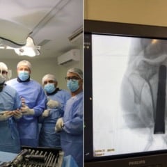 1° dia de osteointegração