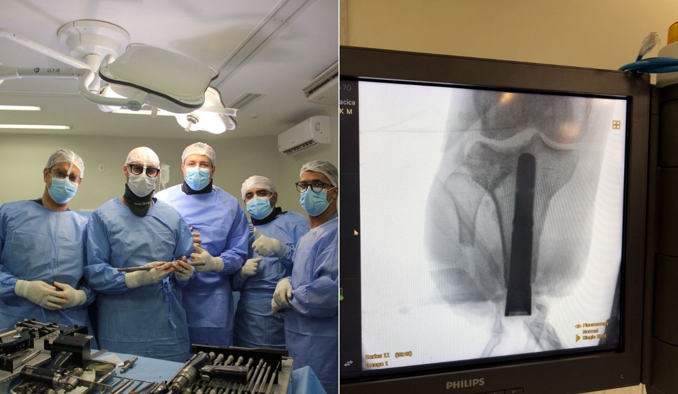 1° dia de osteointegração