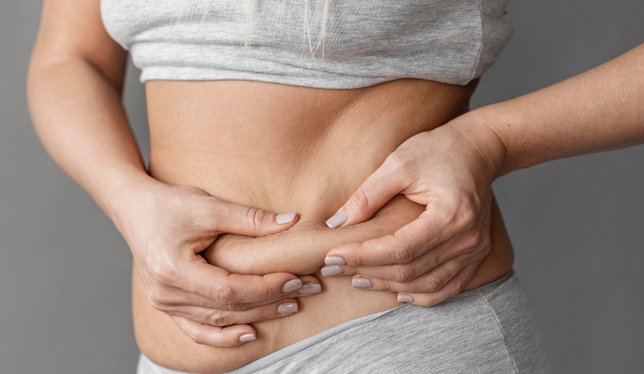 Gordura abdominal Gordura abdominal