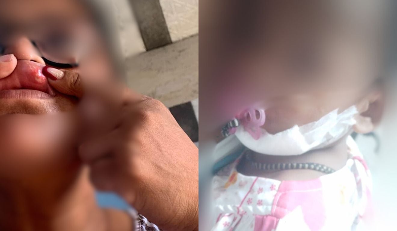 Mulher teve ferimento na boca e bebê de 1 ano precisou levar pontos no queixo. Foto: Reprodução/TV Vitória Mulher teve ferimento na boca e bebê de 1 ano precisou levar pontos no queixo. Foto: Reprodução/TV Vitória