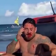 Casal de empres&aacute;rios &eacute; espancado em Porto de Galinhas ap&oacute;s aluguel de cadeira. Foto: Reprodu&ccedil;&atilde;o/Redes Sociais