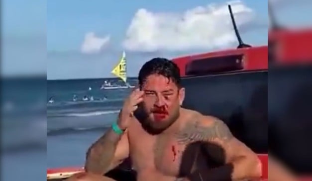 Casal de empresários é espancado em Porto de Galinhas após aluguel de cadeira. Foto: Reprodução/Redes Sociais