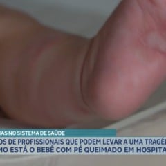 Erro m&eacute;dico causa queimaduras em beb&ecirc; e gera investiga&ccedil;&atilde;o