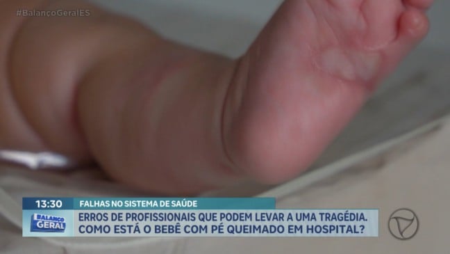 Erro médico causa queimaduras em bebê e gera investigação