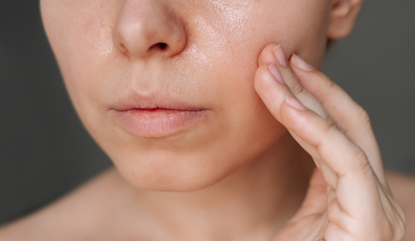 Fim da pele oleosa no calor/Canva Fim da pele oleosa no calor/Canva