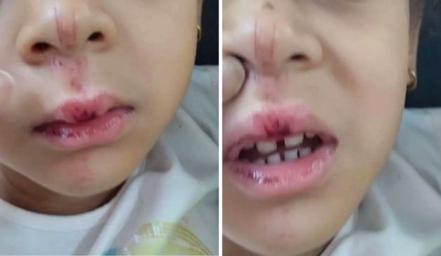 Criança de 4 anos é atropelada por bike elétrica (Foto ReproduçãoTV Vitória)